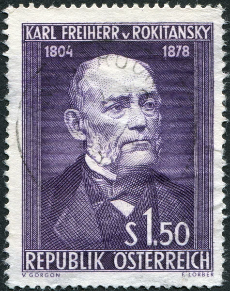 A stamp printed in Austria, is dedicated to the 150th anniversary of Baron Carl von Rokitansky, circa 1954