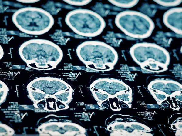 CT scan of human head-brain area
