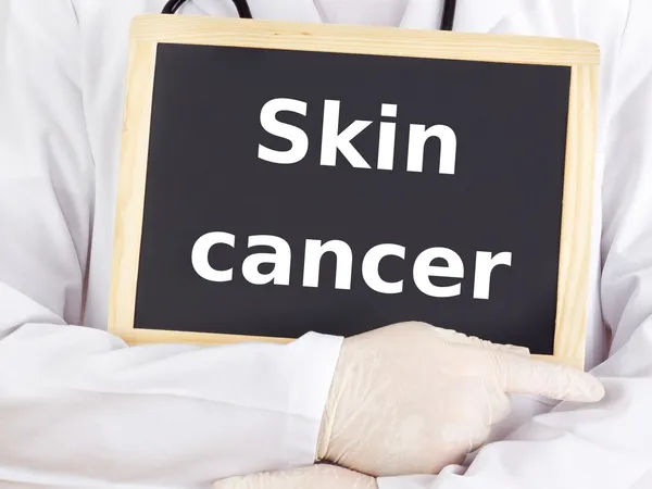 Doctor shows information on blackboard: skin cancer