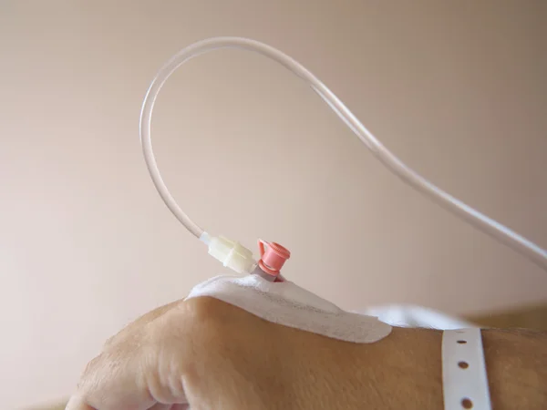 Patient's hand in the hospital with an IV