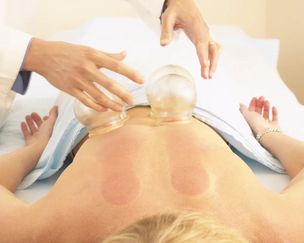 Woman receiving vacuum cupping treatment