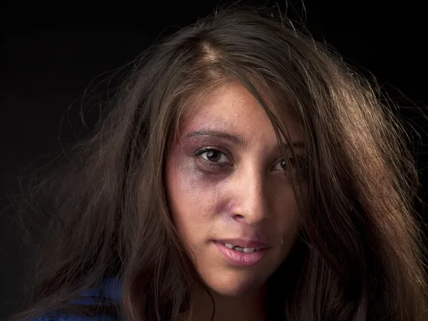 Portrait image of a abused young woman with broken teeth