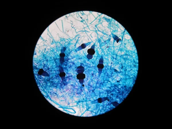 Microscopic view of fungi - sexual reproduction