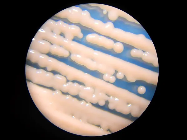 Microscopic / microscope view of pigmented yeast - Rhodotorula rubra