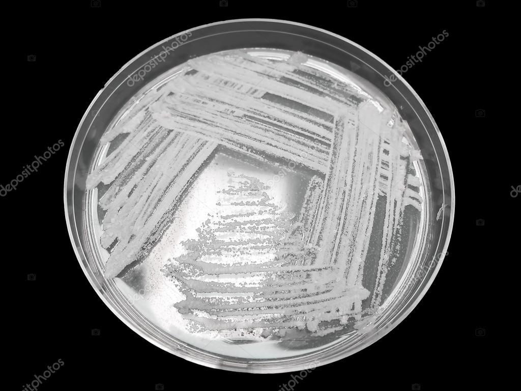 Bacterial pathogen colony / bacteria on an agar streak plate / petri