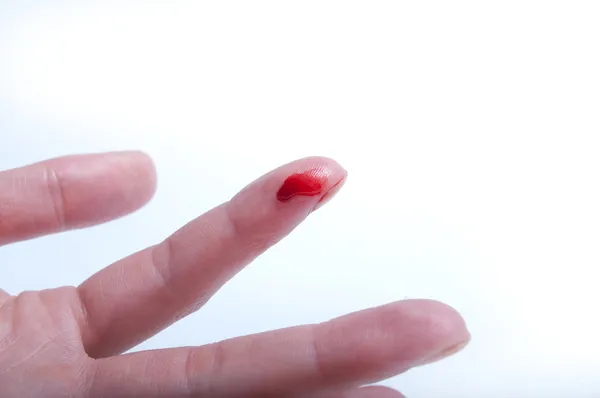 Finger cut