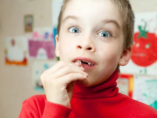 Boy holding missing teeth