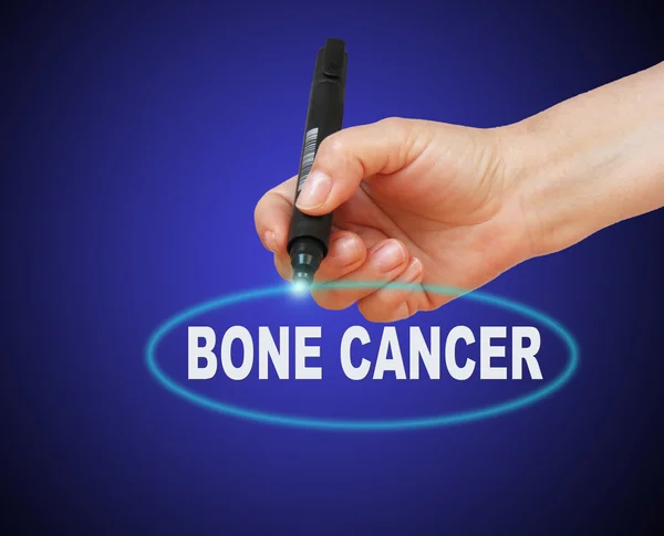 BONE CANCER