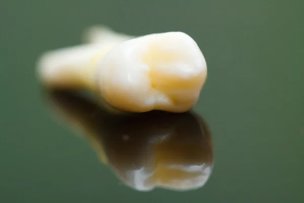 Extracted tooth