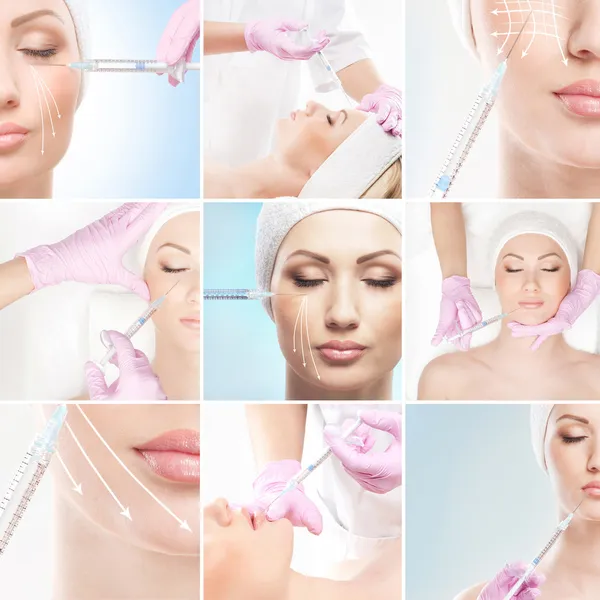 Collection of pictures with face lifting procedures