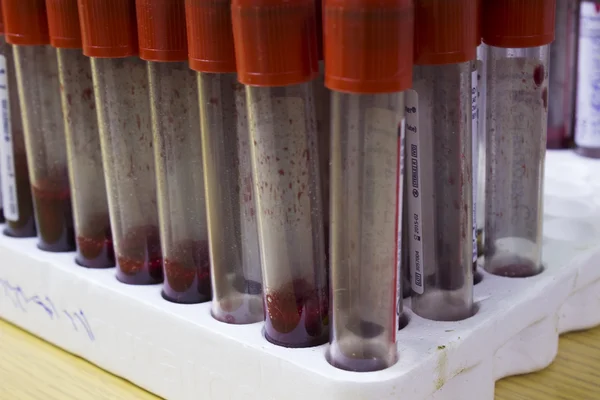 Laboratory testing of blood
