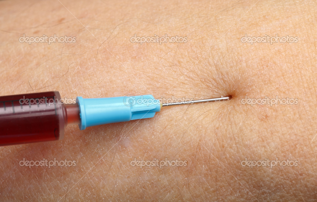 depositphotos_35389635-stock-photo-blood-sampling-with-syringe-and.jpg