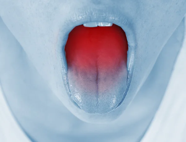 Sore throat, shown red