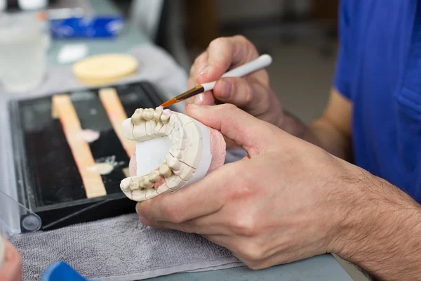 Closeup of a dental technician applying porcelain to a mold