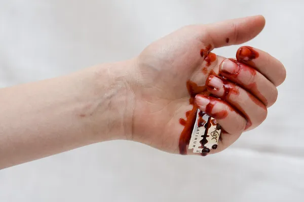 Bleeding hand cut with a razor blade