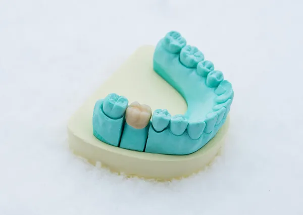 Dental crown