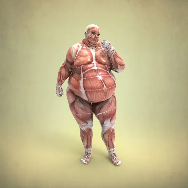 Anatomy of Obese man