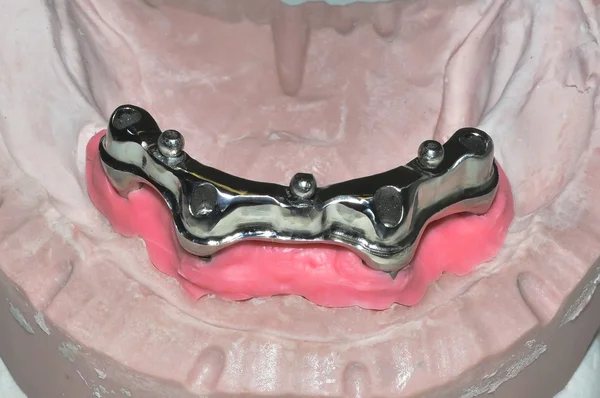 Detail of attachment for prosthesis