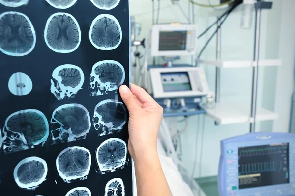 Interpretation of tomography of the brain in the ICU