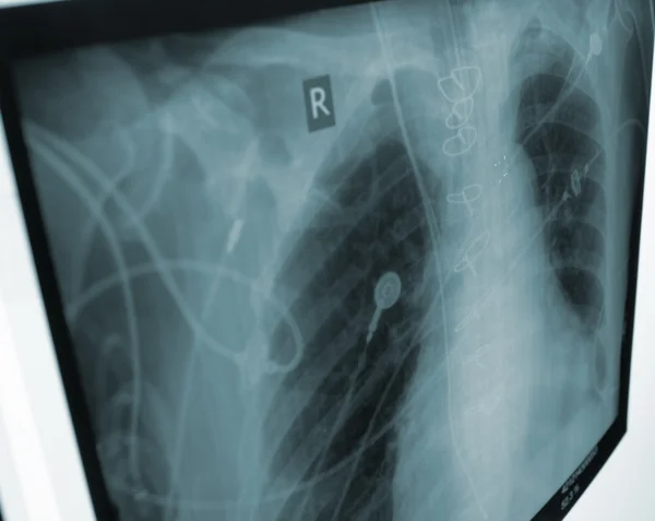 X-ray of the chest in an unusual perspective