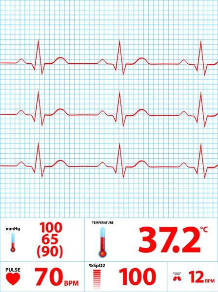 Modern Electrocardiogram Monitor Display