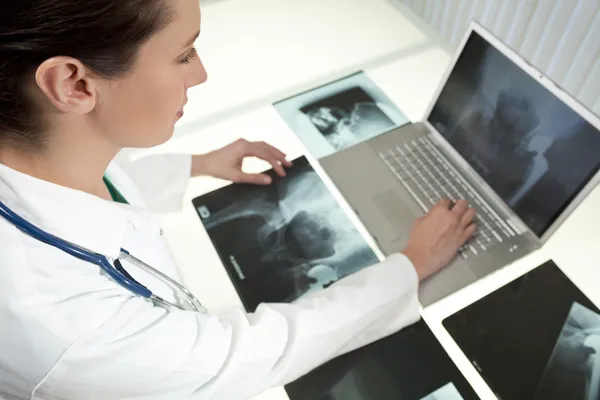 Female Woman Hospital Doctor Looking at X-Rays & Laptop