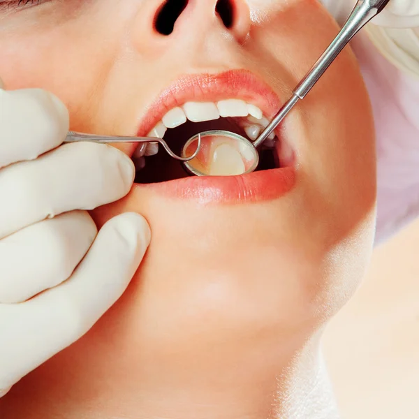 Close up of an dental examination