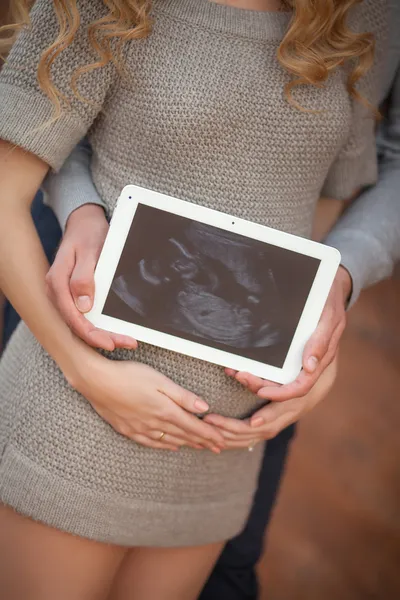 Pregnant woman with husband holding ultrasound scan on her tummy