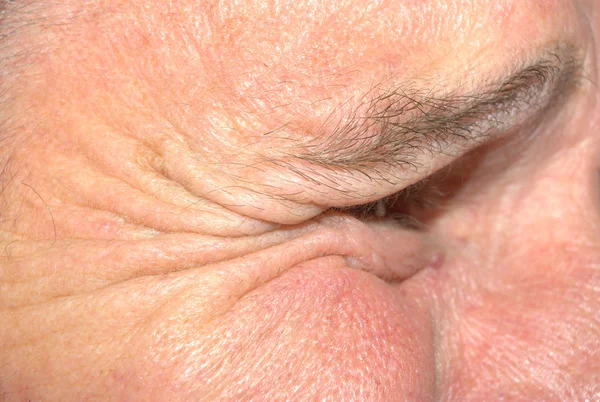 Close up of wrinkles around eye