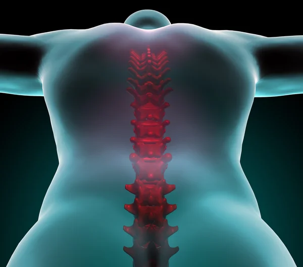 Spine x-ray vision, pain