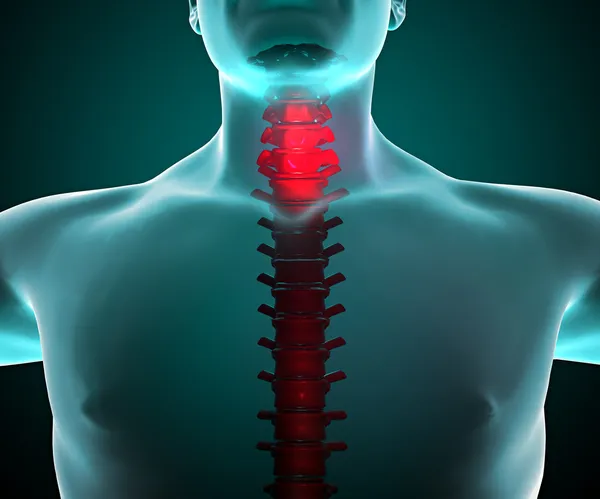 Pain in the neck and spine in a x-ray vision