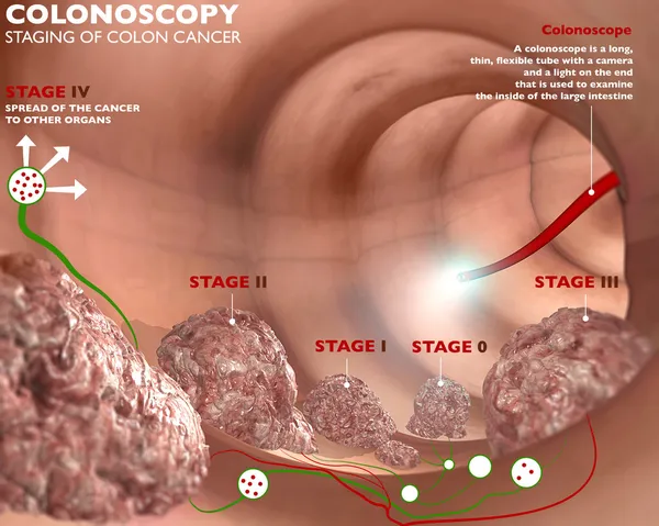 Colonoscopy digestive system