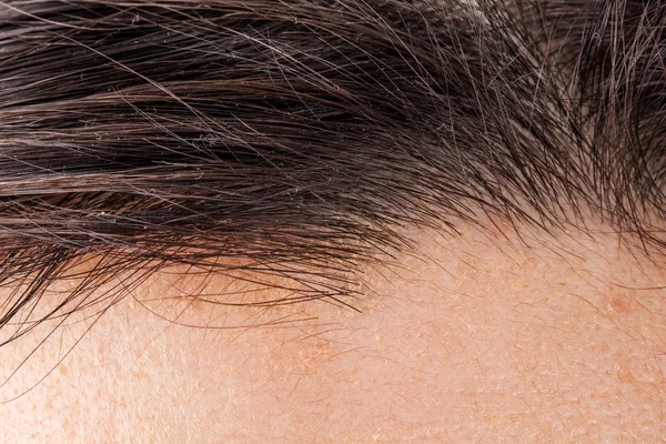 Hair of head