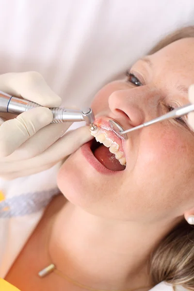 Dental Patient Having Her Teeth Cleaned And Polished By Dentist