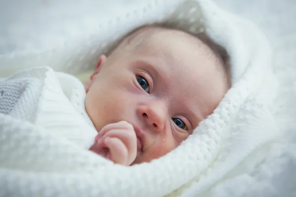 Newborn with Down syndrome is quiet and looks