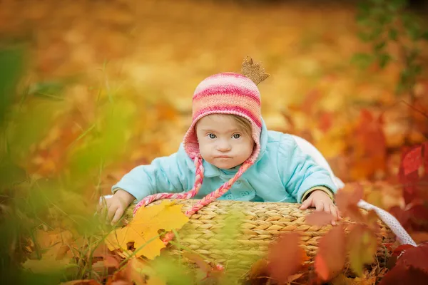 Baby with Down syndrome is resting in autumn forest