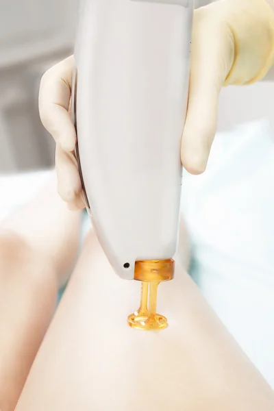 Professional Laser hair epilation