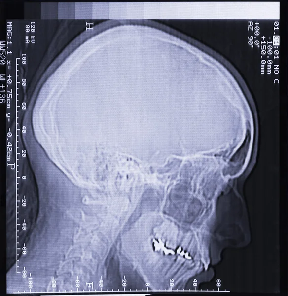 Magnetic resonance scan of human head