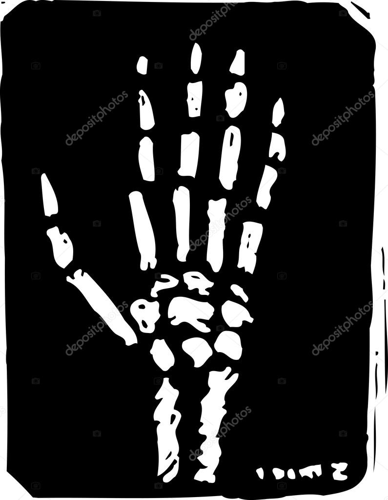 hand x ray clipart - photo #26