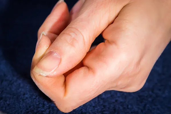 Female hand with colorless varnish on the nails
