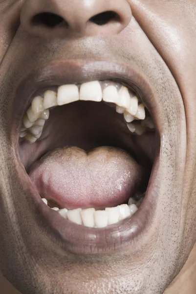 Man\'s mouth wide open