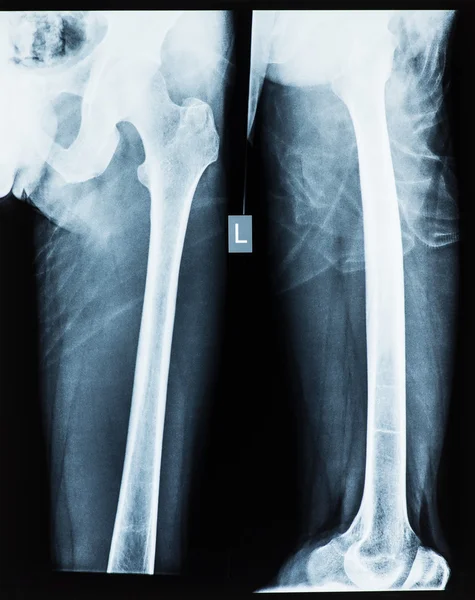 Radiograph of the pelvis and leg