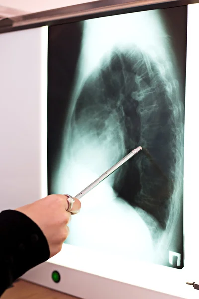 Medicine lab doctor pointing on x-ray no face