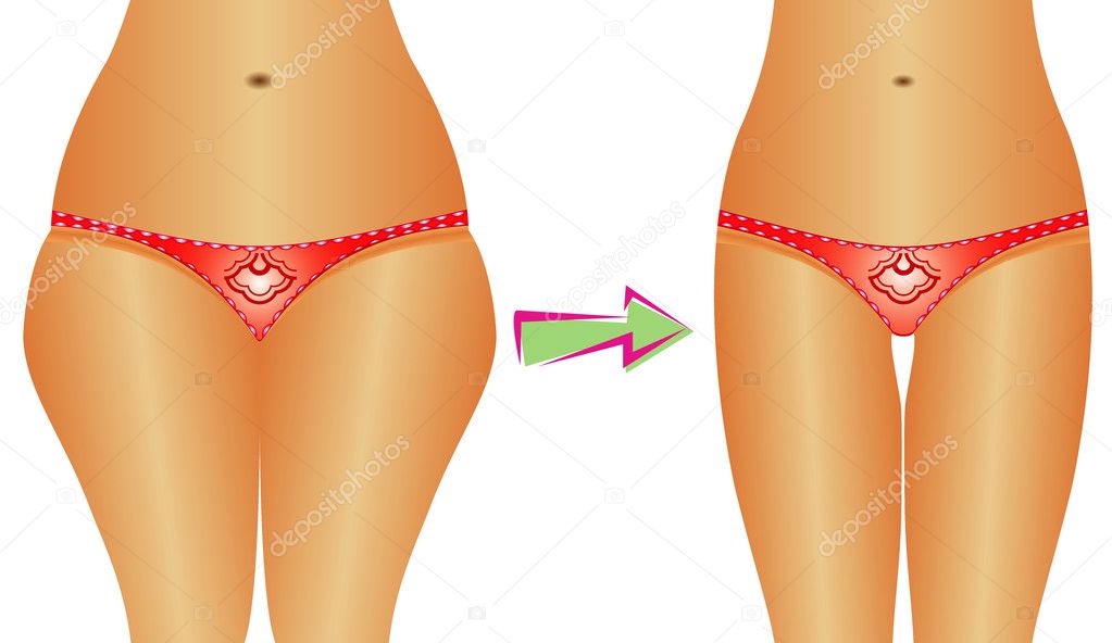 Top T Foods Rapid Weight Loss Ts Woman Before And After Weight Loss Stock Vector 43416953
