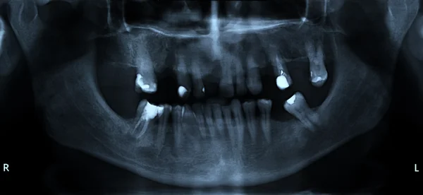 Mouth and dental x-ray