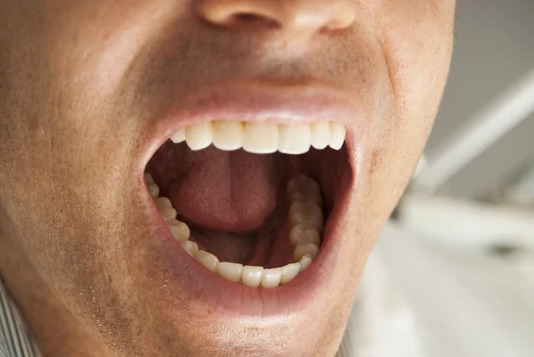 Close-up of a Dental Patient's mouth