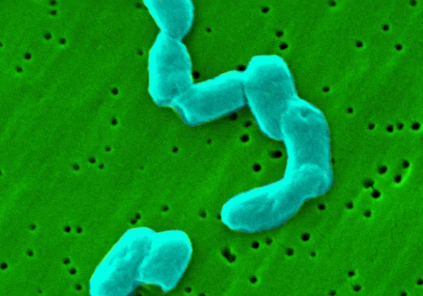 Salmonella bacteria