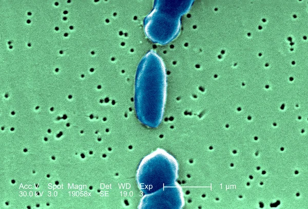 Bacterium under microscope