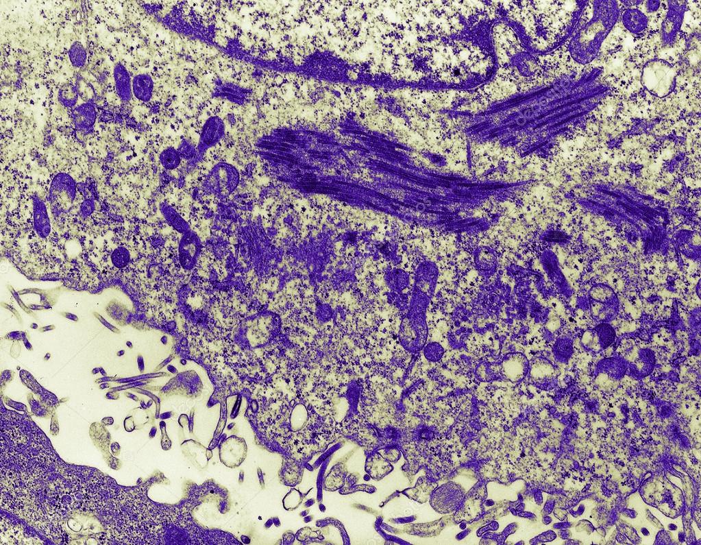 a description of the ebola virus scourge and the different strains (note: the first case of ebola virus disease (evd) diagnosed in the united states occurred yesterday in dallas with this sentinel event, i’ve revisited this article from august to update some of the information. a description of the ebola virus scourge and the different strains (note: the first case of ebola virus disease (evd) diagnosed in the united states occurred yesterday in dallas with this sentinel event, i’ve revisited this article from august to update some of the information.