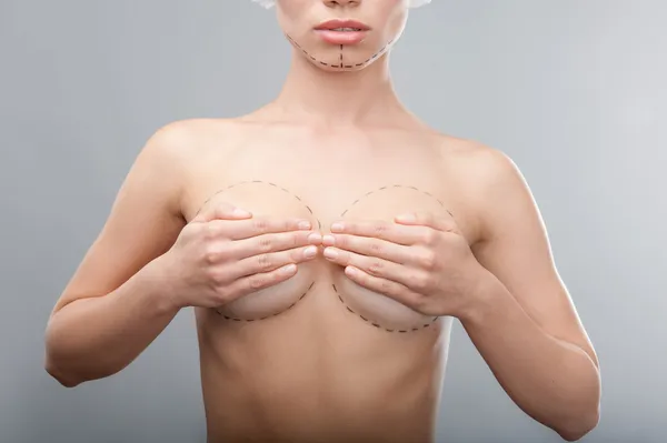 Caucasian womans abdomen marked with lines for abdominal cosme